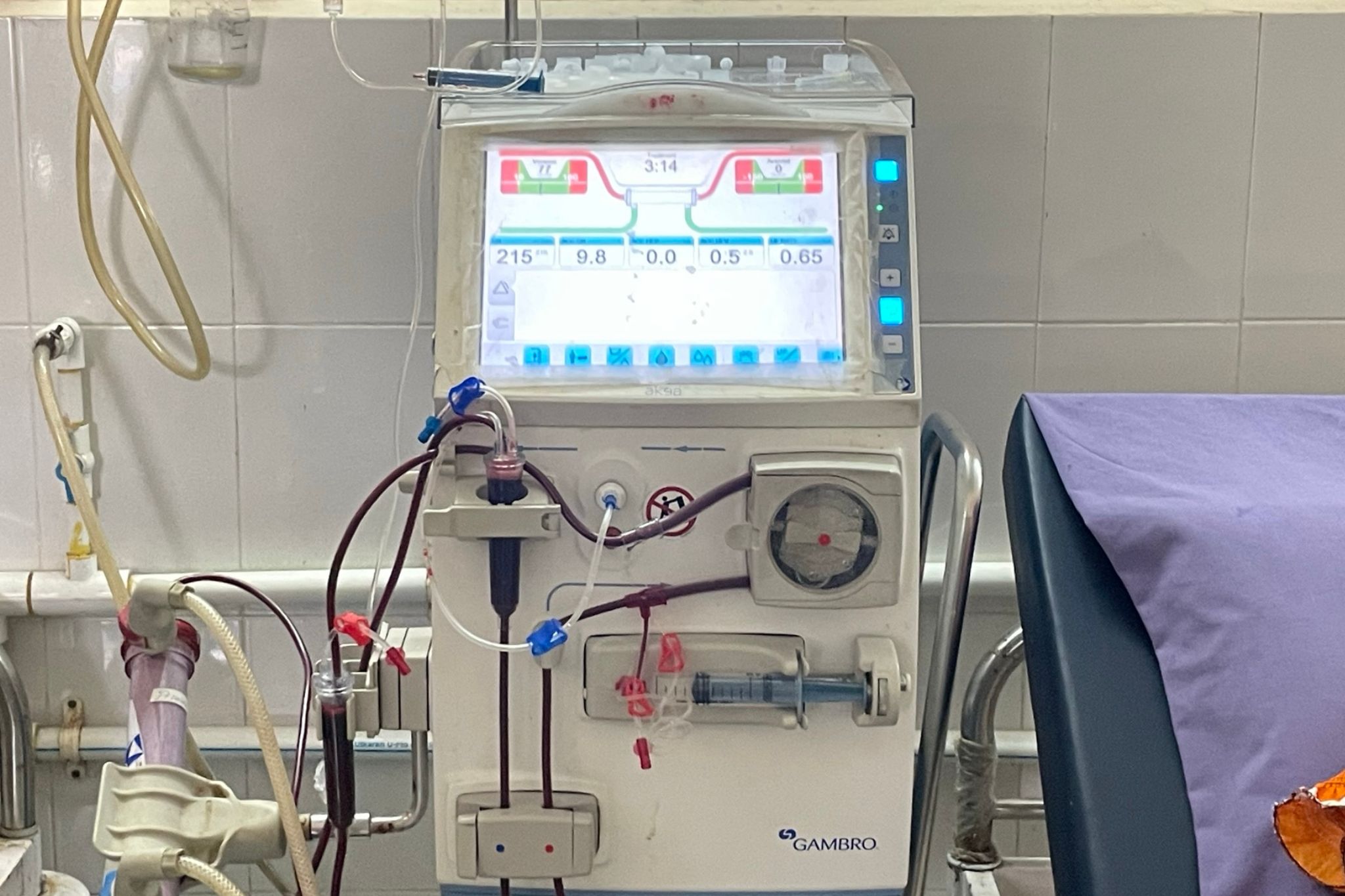 dialysis-1