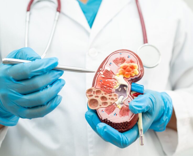 nephrology-f